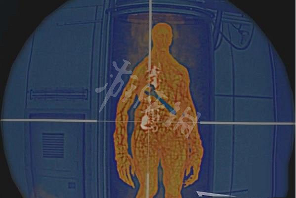 《惡靈古堡4重製版》再生者怎麽打? 再生者擊殺方法 《惡靈古堡4重製版》再生者怎麽打? 再生者擊殺方法