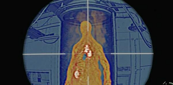 《惡靈古堡4重製版》艾達王dlc華麗的甲蟲位置