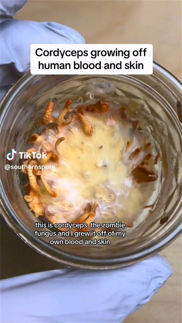 太重口了!《美末》粉絲竟用身體組織培育蟲草菌並品嚐 太重口了!《美末》粉絲竟用身體組織培育蟲草菌並品嚐