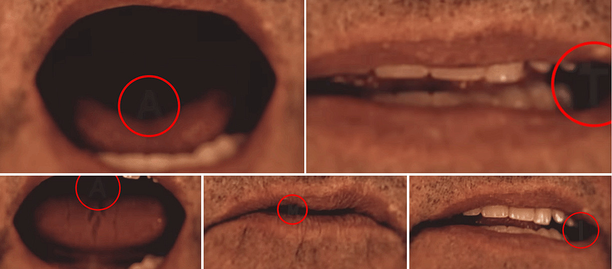 小島秀夫《OD》預告片疑似包含《沉默之丘》相關元素！