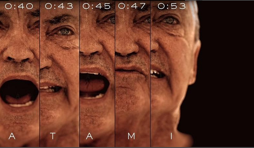 小島秀夫《OD》預告片疑似包含《沉默之丘》相關元素！