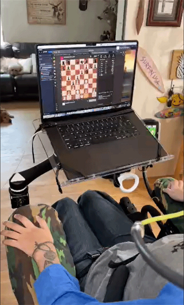 首例腦機接口實驗者近況:能通過意念玩《文明》與下棋