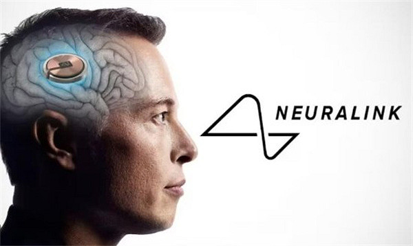 首例腦機接口實驗者近況:能通過意念玩《文明》與下棋